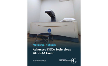 New GE Lunar Prodigy DEXA Installation Completed in Moudania, Halkidiki