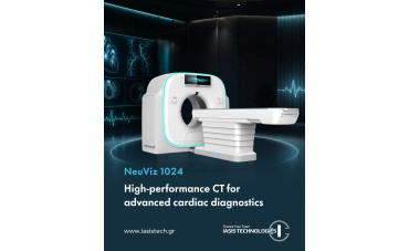 NeuViz 1024: The Power of 1024-Slice CT