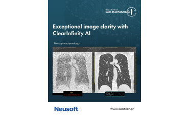 ClearInfinity AI: Exceptional Image Quality with Reduced Radiation Exposure